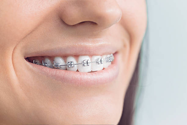 Best Dental Exams and Cleanings  in Canton, OH